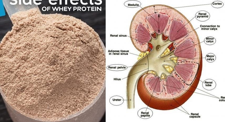 Are There Any Side Effects of Taking Too Much Protein?